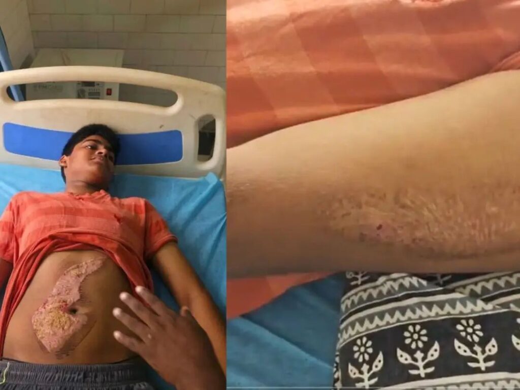 శ్రీచైతన్య హాస్టల్లో ర్యాగింగ్ కలకలం..